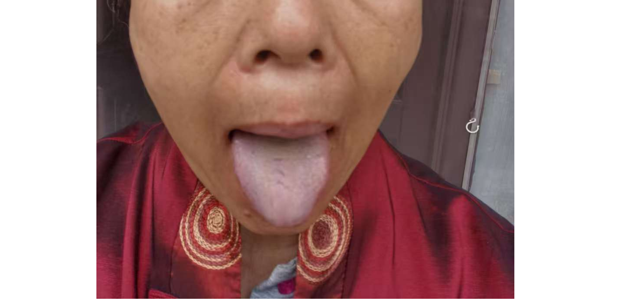 31.png